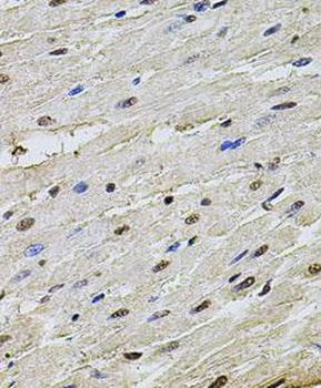 SET Rabbit Polyclonal Antibody