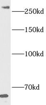 SETD1B Antibody