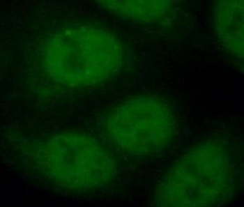 SETD1B Rabbit Polyclonal Antibody