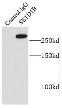 SETD1B Rabbit Polyclonal Antibody