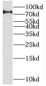 SETMAR Antibody