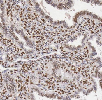 SF3A2 Rabbit Polyclonal Antibody