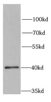 SFRP4 Antibody