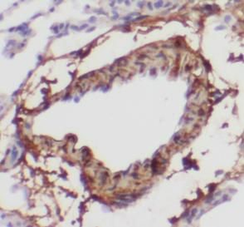 SFTPA1 Antibody