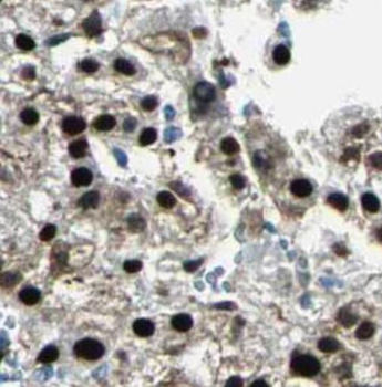 SGF29 Rabbit Polyclonal Antibody