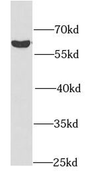 SGK1 Rabbit Polyclonal Antibody