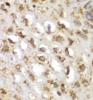 SGK1 Rabbit Polyclonal Antibody