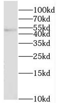 SGK2 Rabbit Polyclonal Antibody