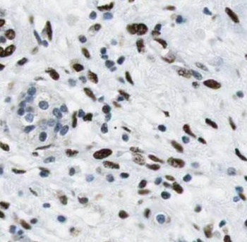 SGK2 Rabbit Polyclonal Antibody