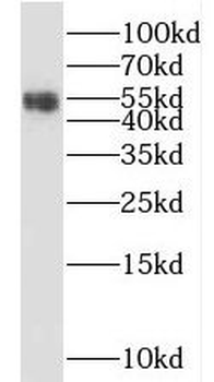 SGMS1 Antibody