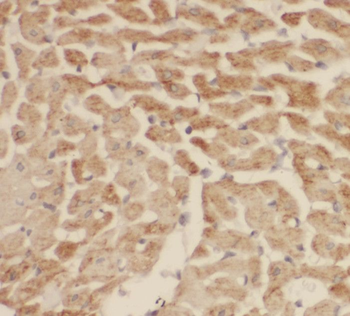 SH3BGR Rabbit Polyclonal Antibody