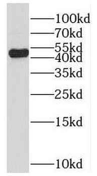 SH3BP5 Rabbit Polyclonal Antibody
