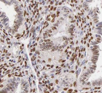 SH3BP5 Rabbit Polyclonal Antibody
