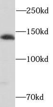 SH3PXD2A Antibody