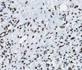 SHC1 Rabbit Polyclonal Antibody