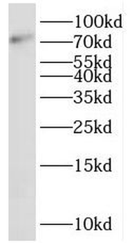 SHCBP1 Rabbit Polyclonal Antibody