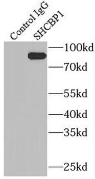 SHCBP1 Rabbit Polyclonal Antibody