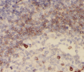 SHCBP1 Rabbit Polyclonal Antibody