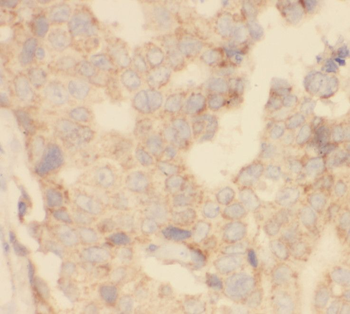 SHE Rabbit Polyclonal Antibody