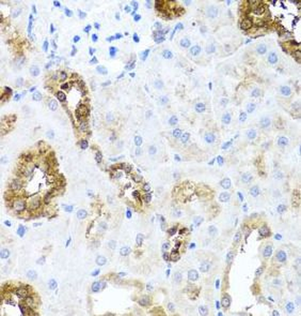 SHH Rabbit Polyclonal Antibody