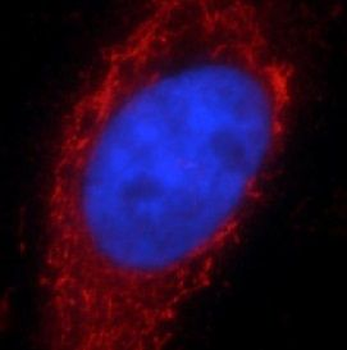 PTPN6 Rabbit Polyclonal Antibody