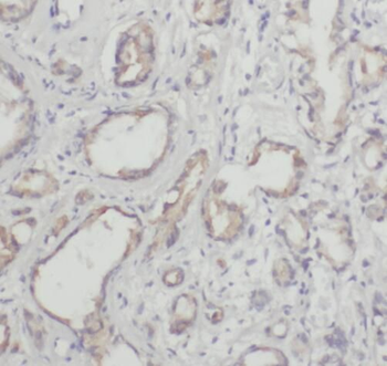 SHPK Rabbit Polyclonal Antibody