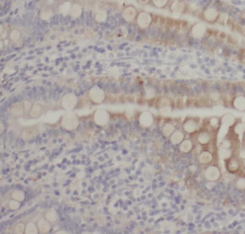 SIDT1 Rabbit Polyclonal Antibody