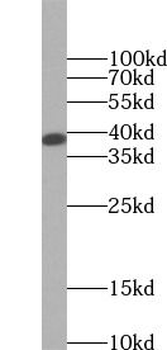 SIRT2 Antibody