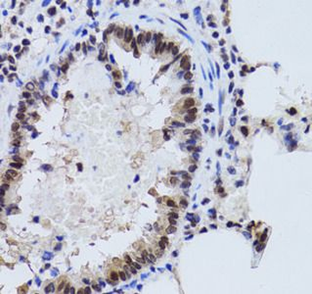 SIRT7 Rabbit Polyclonal Antibody
