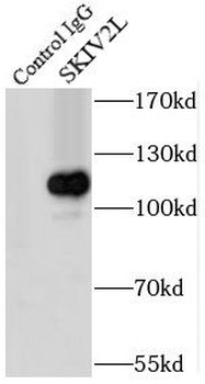 SKIC2 Rabbit Polyclonal Antibody