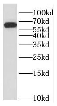 SLAIN2 Antibody