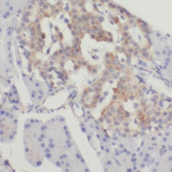 SLC10A3 Rabbit Polyclonal Antibody