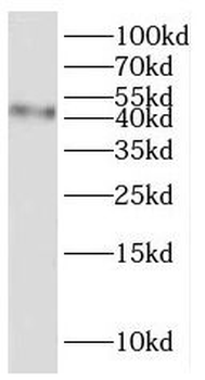 SLC17A5 Antibody