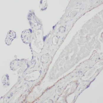 SLC18A1 Rabbit Polyclonal Antibody