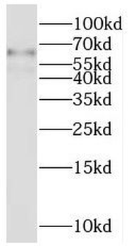 SLC22A1 Antibody