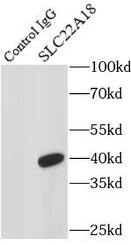 SLC22A18 Rabbit Polyclonal Antibody