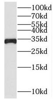 SLC25A15 Rabbit Polyclonal Antibody