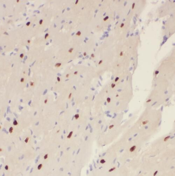SLC25A15 Rabbit Polyclonal Antibody