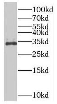 SLC25A6 Rabbit Polyclonal Antibody