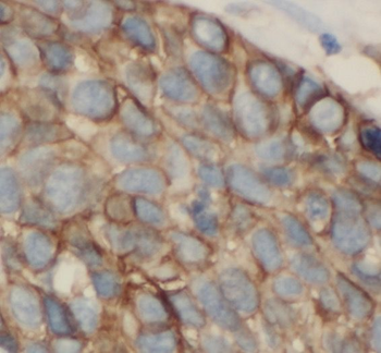 SLC25A6 Rabbit Polyclonal Antibody