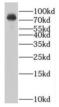 SLC27A3 Antibody