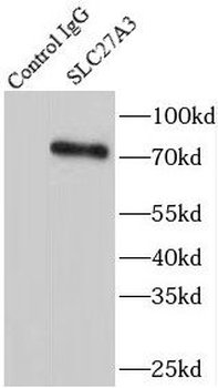 SLC27A3 Rabbit Polyclonal Antibody