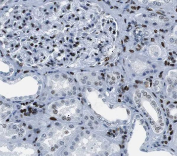 SLC37A4 Rabbit Polyclonal Antibody