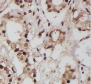 SLC38A1 Rabbit Polyclonal Antibody