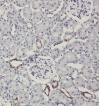 SLC38A4 Rabbit Polyclonal Antibody