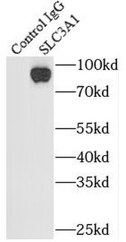 SLC3A1 Rabbit Polyclonal Antibody