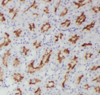 SLC3A1 Rabbit Polyclonal Antibody