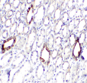 Slco4c1 Rabbit Polyclonal Antibody