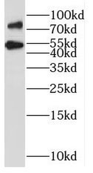 SLCO6A1 Rabbit Polyclonal Antibody