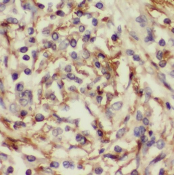 SLCO6A1 Rabbit Polyclonal Antibody